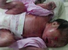 母体染色体有问题做试管婴儿还会有好的胚胎形成吗？